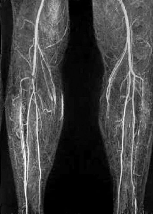Vaskulární x -Ray