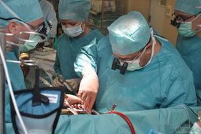 chirurgická léčba křečových žil pánve