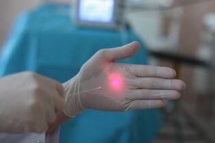 jak se připravit na laserové ošetření křečových žil